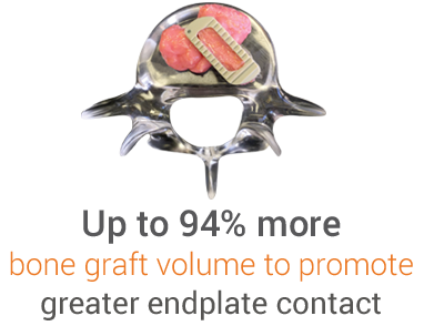 Up to 94% more bone graft volume to promote greater endplate contact